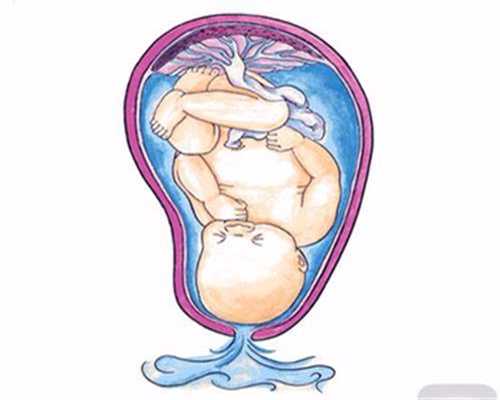 如何做合法代孕-代孕的三种方式-孕前四项检查