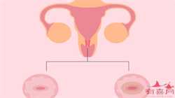 女友检查输卵管狭窄-国内有哪些代孕公司临产时